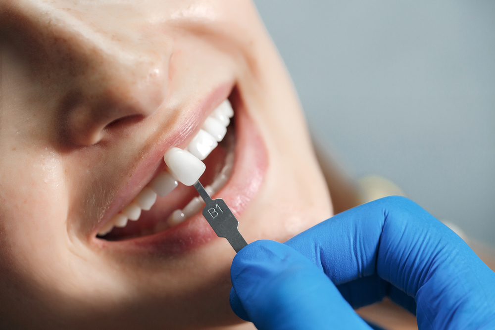 riverside dental implants