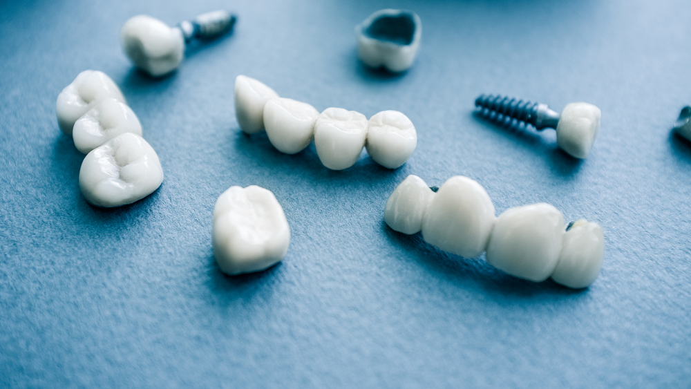 Tips for Faster Dental Implant Recovery