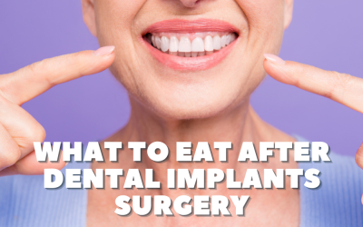 What To Eat After Dental Implants Surgery