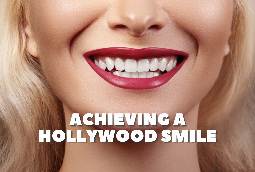 Achieving a Hollywood Smile