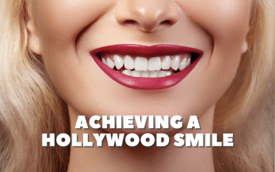 Achieving a Hollywood Smile: Cosmetic Dentistry in Riverside, CA
