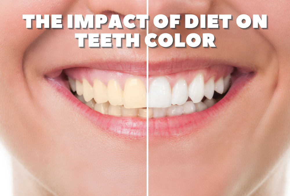 The Impact of Diet on Teeth Color